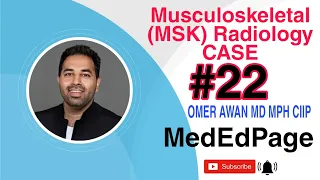 Musculoskeletal (MSK) Radiology CASE #22