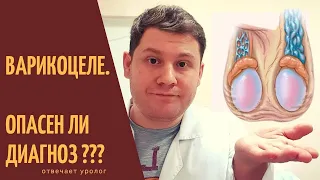 Варикоцеле. Опасен ли диагноз?