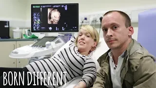 ‘UK’s Shortest Family’ Prepare For Second Baby | BORN DIFFERENT