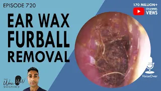 720 - Ear Wax Furball Removal