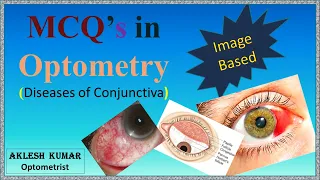 MCQ'S IN OPTOMETRY  || DISEASES OF CONJUNCTIVA || Part 20