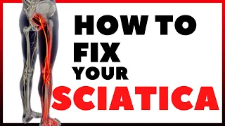 HOW TO FIX YOUR SCIATICA | IN TAGALOG | PHYSICAL THERAPY SESSION