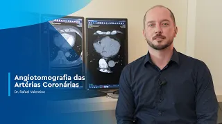 Angiotomografia das Artérias Coronárias - Dr. Rafael Valentini