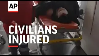 Civilians injured in Russian attacks on Ukraine