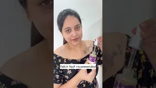 🔥TRY THIS FOR ACNE MARKS & PIGMENTATION😱#shorts #shortsvideo #viral #viralvideo #tamilbeautybeats