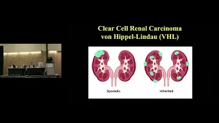 Diagnosis and Management of Localized, Locally Advanced and Advanced Kidney Cancer Webcast (2022)