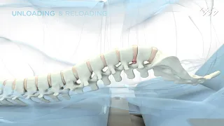 BTL Spinal Decompression - Mechanism of action