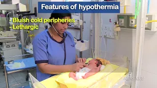 How to manage neonates with severe hypothermia?