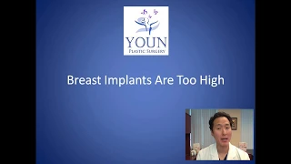 Why Are My Breast Implants So High - Dual Plane Placement Consultation - Dr. Anthony Youn