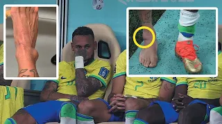 Neymar Ankle injury | Neymar Ankle Sprain | Neymar Injury In World Cup 2022 | Doctor Explains