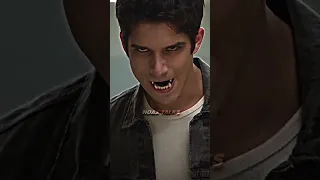 Teen Wolf 🔥 #TeenWolf #TeenWolfMovie #ScottMcCall