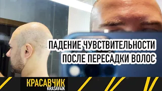 Эффект "в шлеме" после пересадки волос: Падение чувствительности / Красавчик