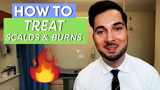 Burns | How To Treat Burns | How To Treat A Burn