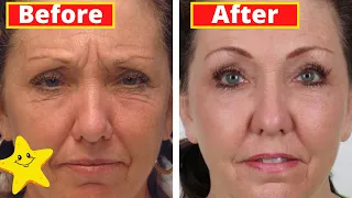 INCREDIBLE EFFECT! Apply once and you will not see more wrinkles on your face // HOME BOTOX