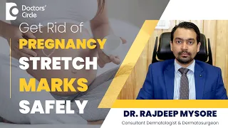Prevention & Treatment Of Stretch Marks During Pregnancy#skincare -Dr.Rajdeep Mysore|Doctors' Circle