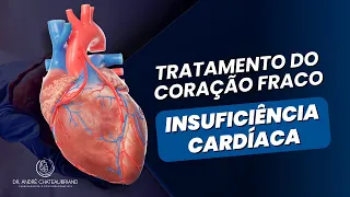 Tratamento do Coração Fraco (Insuficiência Cardíaca) - conheça MAIS sobre