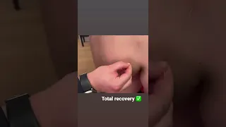 Best muscles recovery