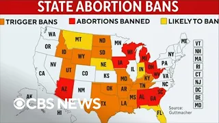 Impact of state abortion bans after Roe v. Wade is overturned