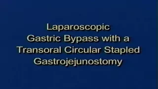 2000 | Laparoscopic Gastric Bypass with a Transoral Circular Stapled Gastrojejunostomy