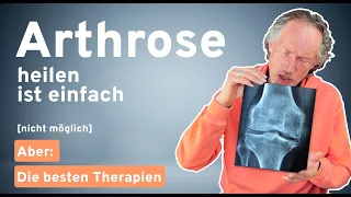 Arthrose verstehen und behandeln: Schmerzfreiheit trotz Arthrose – Die besten Therapieansätze