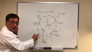 Hering's law, Sherrington's law, Spread of Comitance