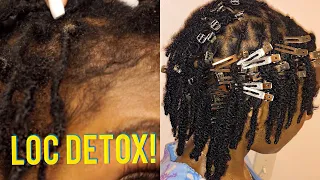 How To: Detox Buildup from Locs| HEAVEN SENT!!! Apple Cidar Vinegar Soak on Locs| iamLindaElaine