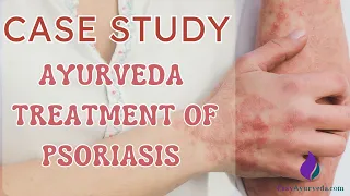 Case Study: Ayurveda Treatment of Psoriasis Only With Ayurveda Medicines And No Panchakarma
