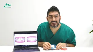 Dimezza i tempi del trattamento ortodontico con Invisalign! Dentista Bologna