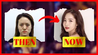 KOREAN ACTORS WITH THE MOST INSANE PLASTIC SURGERIES //PART-1 #kdrama #koreandrama