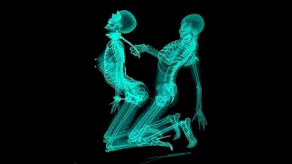 Top 30 Strangest Things Found in an X-Ray I Crazy photos