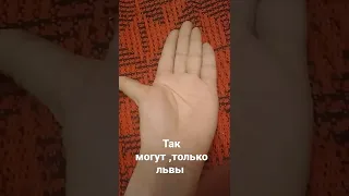 если честно то меня большой палец сломан 😅,а мизинец не сломан я просто так могу