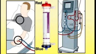 Setting Up of Dialysis Machine