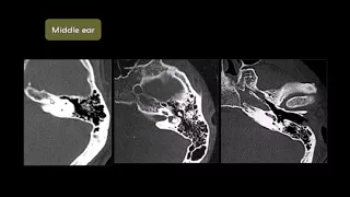 Dr Mamdouh Mahfouz Non Arab Head and neck imaging Petrous bone Anatomy