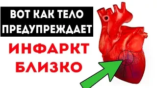 ИНФАРКТ! 5 РАННИХ ПРИЗНАКОВ И СИМПТОМОВ 🌳 Здоровье и долголетие