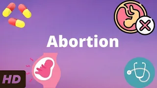 Abortion: Everything You Need To Know