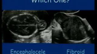 Ultrasound Congenital Anomalies - fetal medicine - fetus