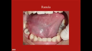 Oral Cavity - CRASH! Medical Review Series