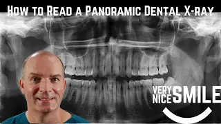 How to read a panoramic dental x ray