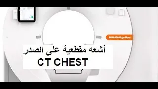 ct chest مقطعية على الصدر اشتباه كرونا COVID 19