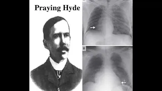 John Hyde || He prayed and his heart literally shifted position from left to right || In Hindi