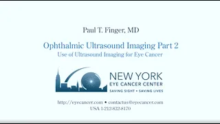 Ophthalmic Ultrasound Imaging Part II: Use of Ultrasound Imaging for Eye Cancer