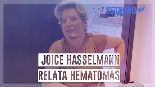 Joice Hasselmann reconstitui episódio sobre seus ferimentos