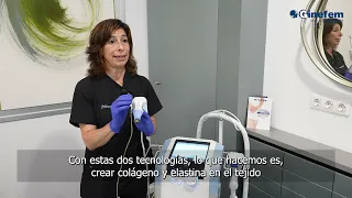 EXILIS ULTRA 360 Utiliza radiofrecuencia y ultrasonido en la zona vaginal