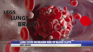 Long COVID increases risk of blood clots