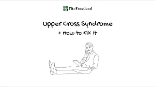 Upper Cross Syndrome copy