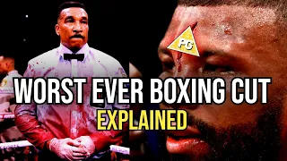 WORST EVER BOXING CUT EXPLAINED TONY WEEKS