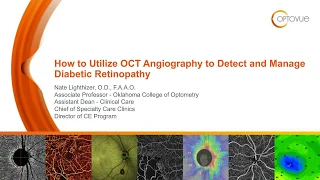 How to Utilize OCT Angiography to Detect and Manage Diabetic Retinopathy