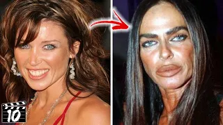 Top 10 Celebrities You Won't Recognize After Plastic Surgery | Marathon