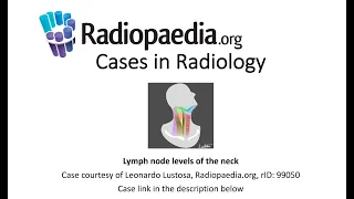 Lymph node levels of the neck (Radiopaedia.org) Cases in Radiology