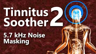 Tinnitus Soother 2 Noise 5700 Hz Focused Noise Masking